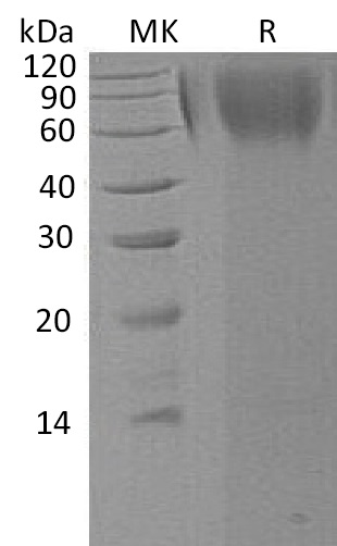 Human LAMP1 +SDS-PAGE.jpg